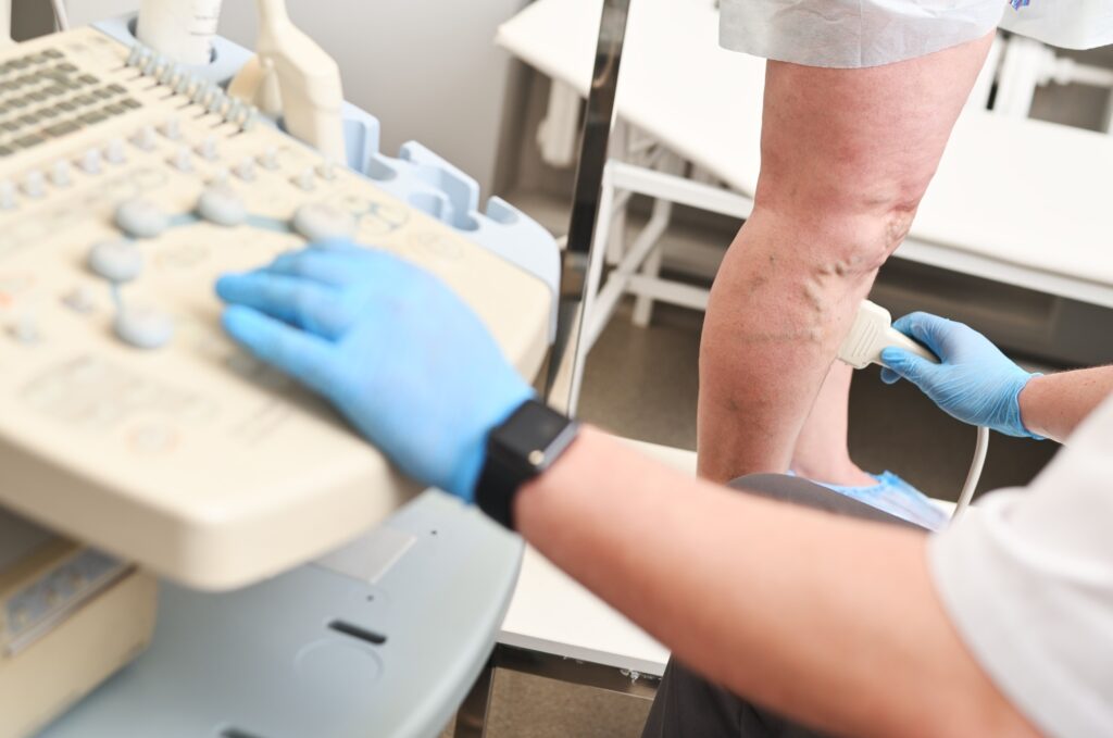 a phlebologist does an ultrasound of the veins of a patient with varicose veins.